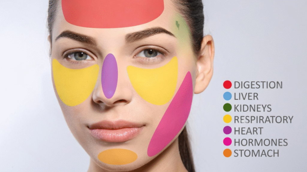 Acne Map: Powerful Guide to Decode Your Skin Breakouts