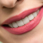 Ceramic Teeth Cap: The Ultimate Guide to Ceramic Caps for Teeth